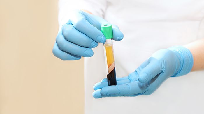 There Is More to PRP Than Price